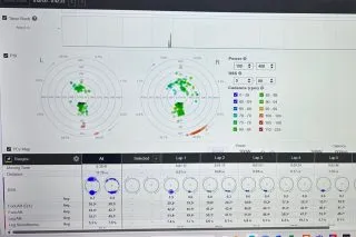 Velogicfit pedal analysis data dashboard